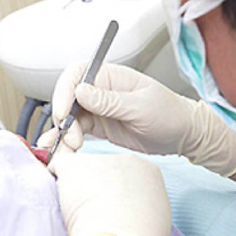 できる限り歯を削らずに残す治療